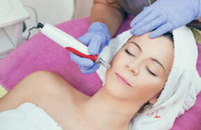 Microneedling